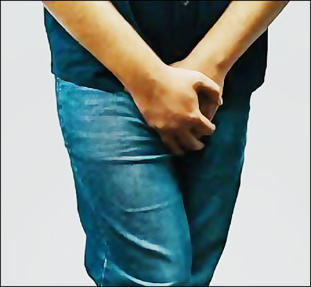 hypertension épididymaire