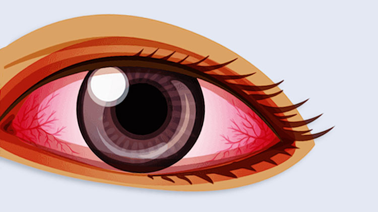 toxicomane yeux injectes de sang